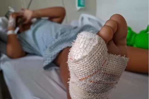 Crianças são mutiladas em brinquedo de condomínio no Litoral Norte da Bahia